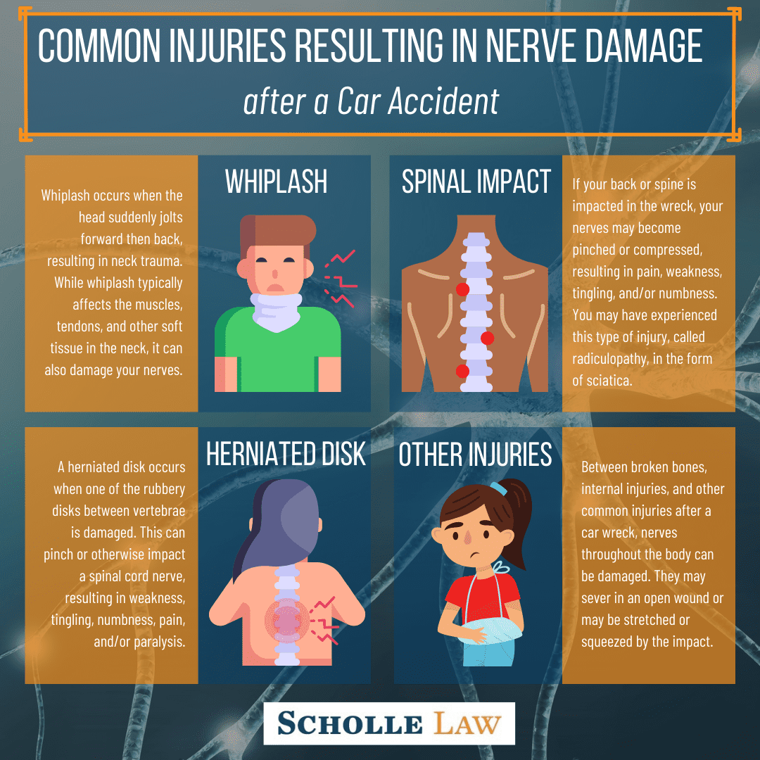 Car Accident Nerve Damage What You Need To Know Scholle Law Personal 